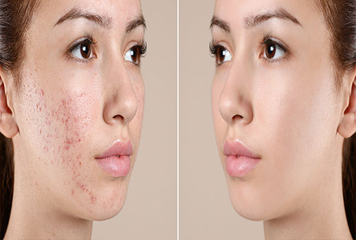 beauty retouching service